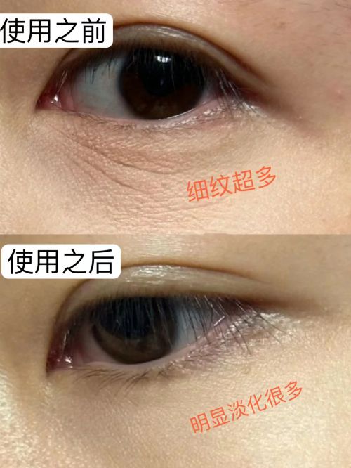 ？2025眼霜测评总结分享干货！OG真人游戏什么眼霜去皱效果好(图9)